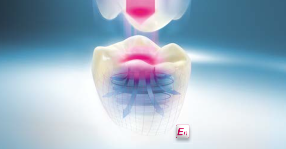 VITA ENAMIC – UNIVERSAL - Not for CEREC & inLab VITA ENAMIC – UNIVERSAL - Not for CEREC & inLab