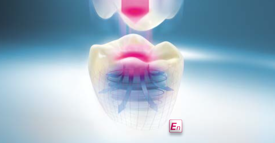 VITA ENAMIC – UNIVERSAL - Not for CEREC & inLab