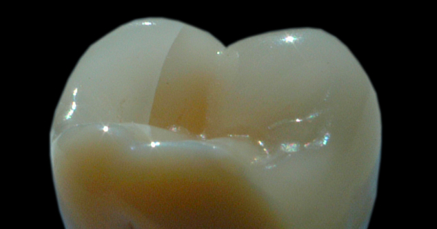 Polishing Polishing