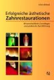 Erfolgreiche ästhetische Zahnrestaurationen Wissenschaftliche Grundlagen und praktische Durchführung - Ahmad, Irfan