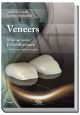 Veneers - Attilio Sommella